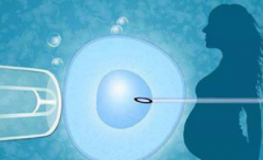 成都多囊卵巢试管治疗医院排行榜：最强技术与服务全解析