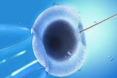 人工授精确保生育男孩的费用是多少？全面解析费用构成与注意事项