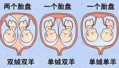 单绒和双绒双胞胎区别大，一文教你看懂差别！