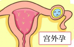 做完宫外孕手术为什么肚子胀？可能是这些原因导致的！