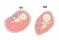 怀孕时什么原因引起胎动变多？盘点常见因素！