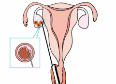 长治医学院附属和平医院试管费用全解析：一次治疗究竟需要多少花费