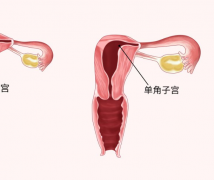单角子宫怎么才能自然怀孕？这些方法能帮你有效助孕！