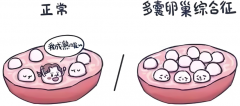 多囊患者必看：促排后出现空卵泡，方案选择是关键！