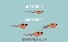 男性畸形精子危害大，可以用这些办法来改善精子质量！