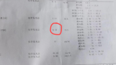 哪些原因导致fsh值偏高？一般由卵巢早衰引起！