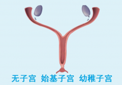 女性幼稚子宫没有月经能做试管婴儿吗？答案是肯定的！
