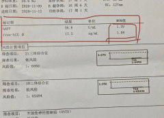 孕妇什么时候做唐氏筛查好？一定要注意这个时间点！