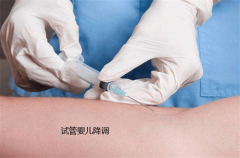 降调人工周期移植冻胚的奇妙之旅：一步步揭开神秘面纱