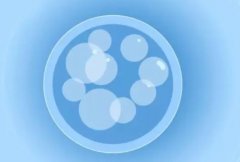 多囊卵巢综合征发病全解析：多种因素如何共同作用？