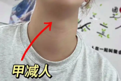 男性甲减影响生育怎么办？教你几个助孕方法！
