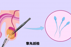 什么是无精症？盘点影响无精症患者做试管的主要因素！