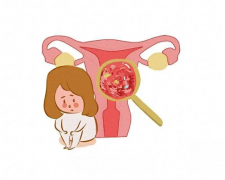全面解析输卵管不通的检查项目：一步步揭开孕育难题的神秘面纱，助你早日找到解决之道