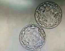 解析试管4aa囊胚，质量好移植成功率高！
