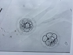 解析不同等级囊胚着床时间，对比4ba和4bc囊胚！