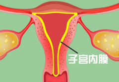 女性子宫内膜炎影响生育，导致不孕问题产生！