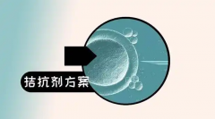 科普试管拮抗剂方案，哪些人适合选择？