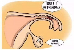对比检查输卵管堵塞的几种方法，哪种效果好？