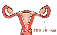长沙输卵管粘连姐妹别愁！试管影响、办法和成功率竟藏着这些秘密？