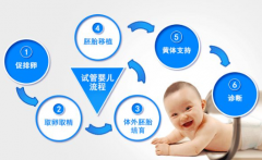 2025杭州试管双胞胎生男孩全流程解析：费用、成功率及医院推荐