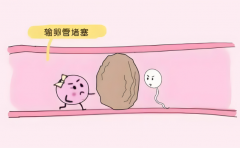 输卵管堵塞不孕怎么治？手术与试管综合评估攻略来啦！