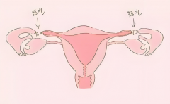 输卵管结扎后做试管成功率有多高？不同年龄真实数据对比！