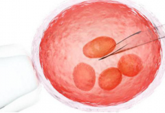 好柿生殖:吉尔吉斯斯坦孕育助孕公司低价现象真相